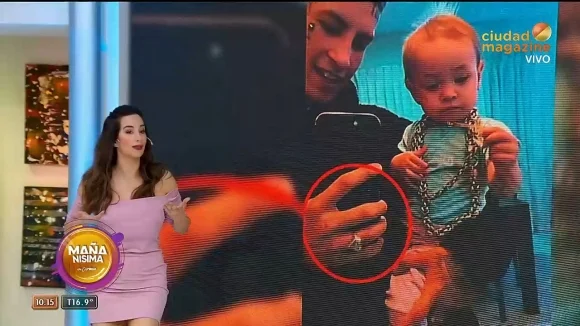 lgante manos lastimadas jamaica